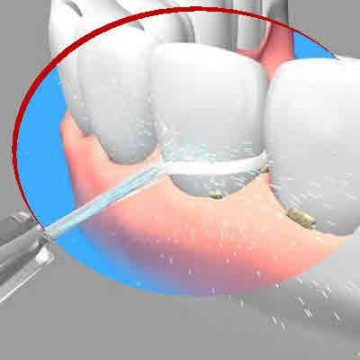 Is Regular Flossing Important to your Oral Health?