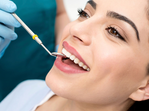 dental sealants, Marietta