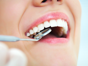 Periodontal Services